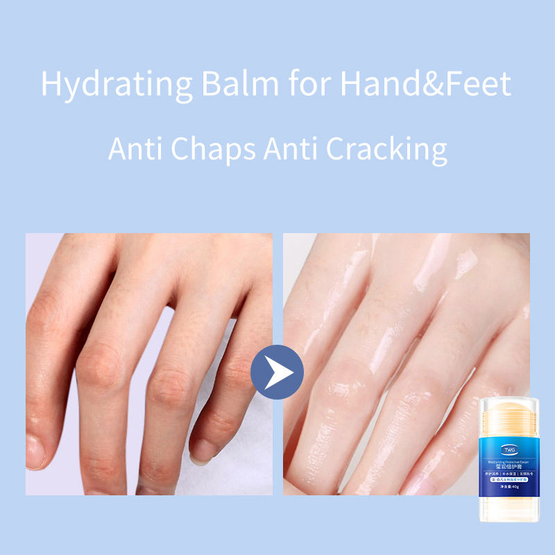 TWG Foot Hydrating Balm – Moisturizing Anti-Crack Hand & Foot Care Balm